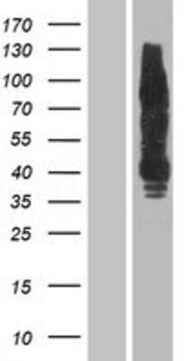 Western Blot: ErbB4/Her4 Overexpression Lysate [NBP2-04281]