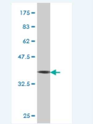 Western Blot: Erbin Antibody (10D2) [H00055914-M02]