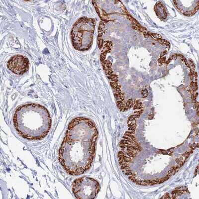 Immunohistochemistry-Paraffin: Erbin Antibody [NBP2-13968]