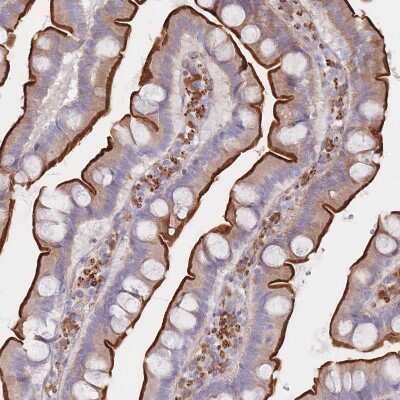 Immunohistochemistry-Paraffin: Erbin Antibody [NBP2-13968]