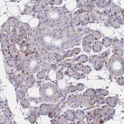Immunohistochemistry-Paraffin: Erbin Antibody [NBP2-13968]