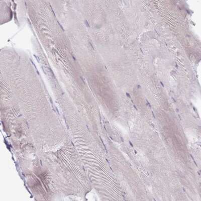 Immunohistochemistry-Paraffin: Erbin Antibody [NBP2-13968]