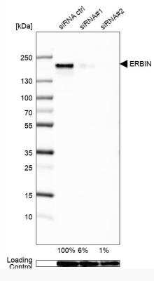 Western Blot: Erbin Antibody [NBP2-13968]