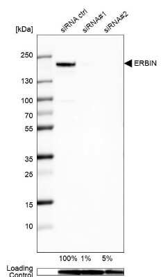 Western Blot: Erbin Antibody [NBP2-56104]