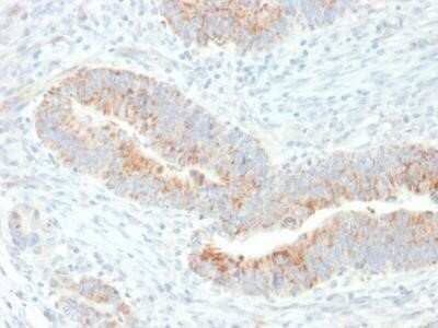 Immunohistochemistry-Paraffin: Erythropoietin/EPO Antibody (EPO/1367) - Azide and BSA Free [NBP2-54447]