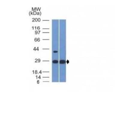 Western Blot: Erythropoietin/EPO Antibody (EPO/1368)Azide and BSA Free [NBP2-54537]