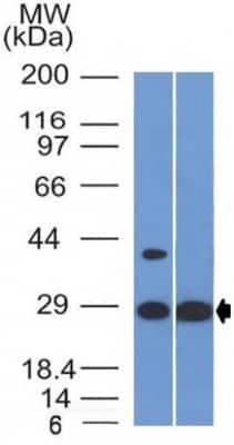 Western Blot: Erythropoietin/EPO Antibody (EPO/1368) [NBP2-53392]