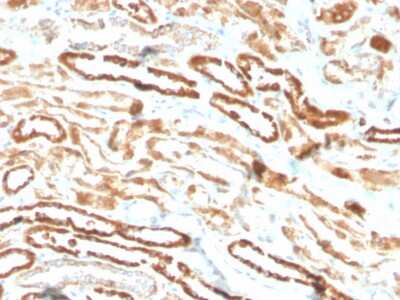 Immunohistochemistry-Paraffin: Erythropoietin/EPO Antibody (EPO/3793R) - Azide and BSA Free [NBP3-08895]