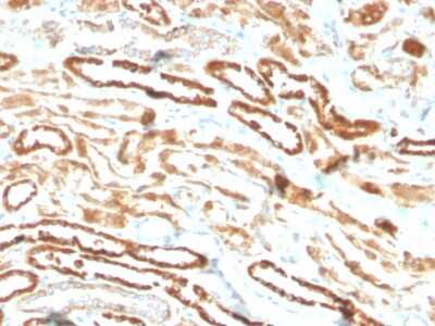 Immunohistochemistry-Paraffin: Erythropoietin/EPO Antibody (EPO/3793R) [NBP3-07153]