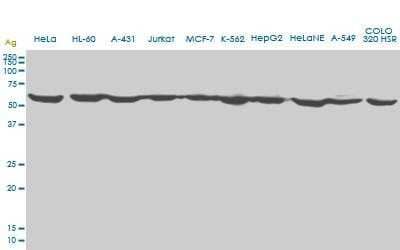 Western Blot: Erythropoietin R Antibody (3D10) [H00002057-M01]