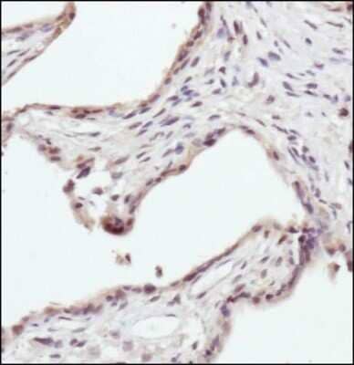 Immunohistochemistry-Paraffin: Erythropoietin R Antibody - BSA Free [NBP1-19388]