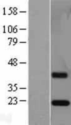 Western Blot: Endocan/ESM-1 Overexpression Lysate [NBL1-10343]