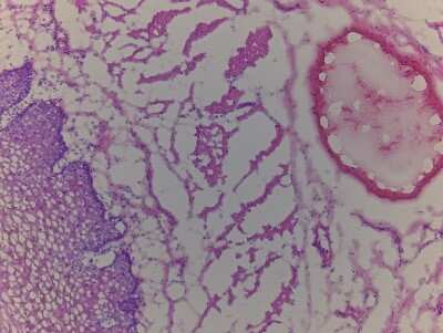 Hematoxylin & Eosin Stain: Esophagus Tissue Slides (Adult Normal)- Frozen [NBP2-77568]