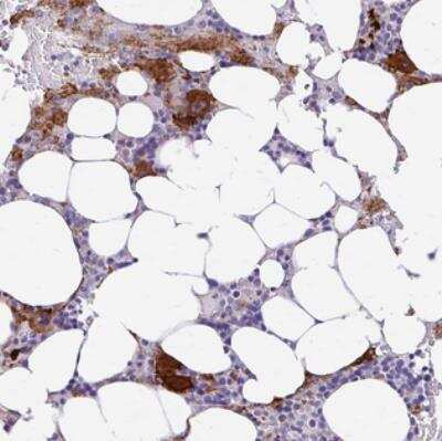 Immunohistochemistry: Espin-Like Protein Antibody [NBP2-30813]