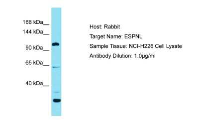 Western Blot: Espin-Like Protein Antibody [NBP2-83022]