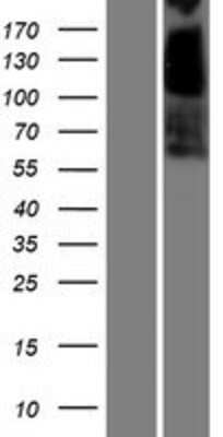 Western Blot: Carboxylesterase 3/CES3/Esterase 31 Overexpression Lysate [NBP2-06258]