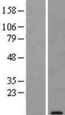 Western Blot: TFF1/pS2 Overexpression Lysate [NBL1-16839]