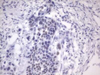 Immunohistochemistry: ER alpha/NR3A1 Antibody (OTI2D3) [NBP2-45522]