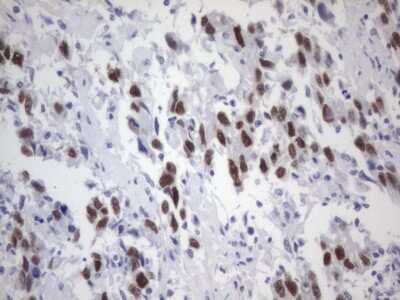 Immunohistochemistry: ER alpha/NR3A1 Antibody (OTI2D3) [NBP2-45522]