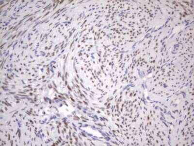Immunohistochemistry: ER alpha/NR3A1 Antibody (OTI2D3) [NBP2-45522]