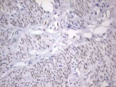 Immunohistochemistry: ER alpha/NR3A1 Antibody (OTI2D3) [NBP2-45522]
