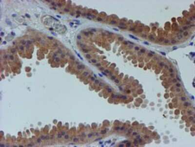 Immunohistochemistry-Paraffin: ER alpha/NR3A1 Antibody (OTI1B1) [NBP2-01371]