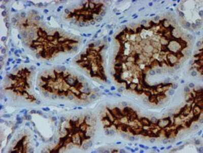 Immunohistochemistry-Paraffin: ER alpha/NR3A1 Antibody (OTI1B1) [NBP2-01371]