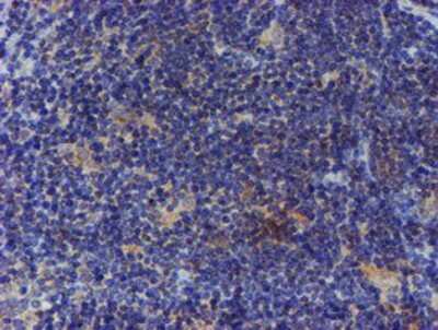 Immunohistochemistry-Paraffin: ER alpha/NR3A1 Antibody (OTI1B1) [NBP2-01371]