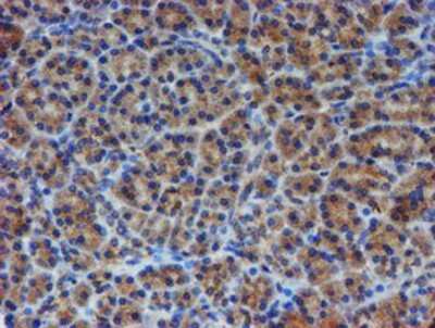 Immunohistochemistry-Paraffin: ER alpha/NR3A1 Antibody (OTI1B1) [NBP2-01371]