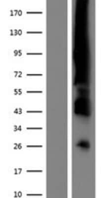 Western Blot: ER alpha/NR3A1 Overexpression Lysate [NBL1-10344]