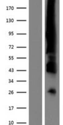 Western Blot: ER alpha/NR3A1 Overexpression Lysate [NBP2-11397]