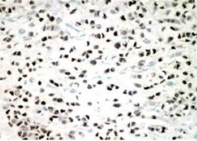 Immunohistochemistry-Paraffin: ER beta/NR3A2 Antibody (14C8) [NB200-305]