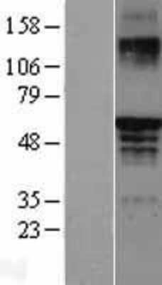 Western Blot: ER beta/NR3A2 Overexpression Lysate [NBL1-10345]