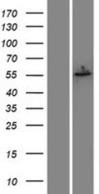 Western Blot: ER beta/NR3A2 Overexpression Lysate [NBP2-10628]