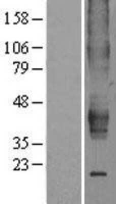 Western Blot: ERR beta/NR3B2 Overexpression Lysate [NBP2-04272]