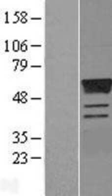 Western Blot: ERR gamma/NR3B3 Overexpression Lysate [NBL1-10347]