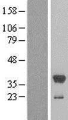 Western Blot: Cytosolic Sulfotransferase 1E1/SULT1E1 Overexpression Lysate [NBL1-16606]