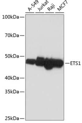 Western Blot: Ets-1 Antibody (5P4K1) [NBP3-15807]