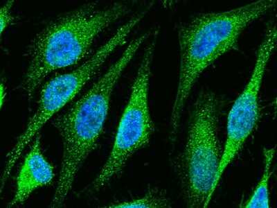 Immunocytochemistry/ Immunofluorescence: Ets-1 Antibody [NBP2-98794]