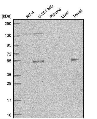 Western Blot: Ets-1 Antibody [NBP2-56897]