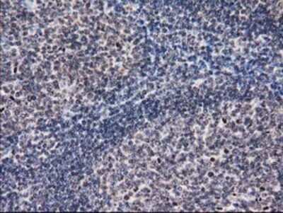 Immunohistochemistry-Paraffin: Eukaryotic translation initiation factor 1 Antibody (OTI2B9) [NBP2-00702]