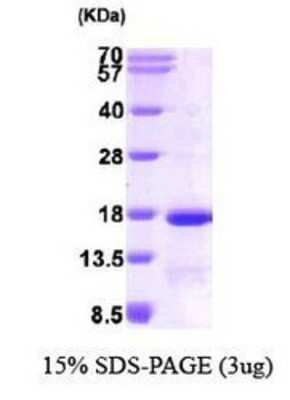 SDS-PAGE: Recombinant Human Eukaryotic translation initiation factor 1 His Protein [NBP1-37080]