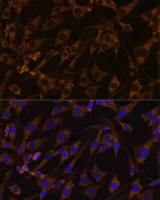 Immunocytochemistry/ Immunofluorescence: Eukaryotic translation initiation factor 5B Antibody - Azide and BSA Free [NBP3-03412]