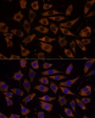 Immunocytochemistry/ Immunofluorescence: Eukaryotic translation initiation factor 5B Antibody - Azide and BSA Free [NBP3-03412]