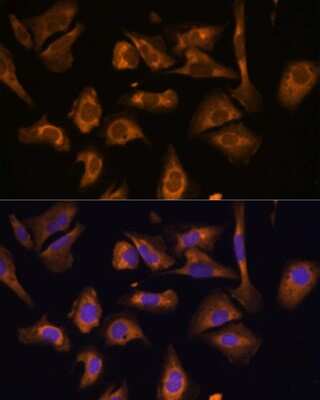 Immunocytochemistry/ Immunofluorescence: Eukaryotic translation initiation factor 5B Antibody - Azide and BSA Free [NBP3-03412]