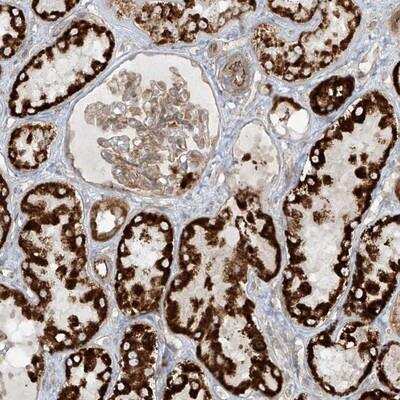 Immunohistochemistry-Paraffin: Eukaryotic translation initiation factor 5B Antibody [NBP1-85120]