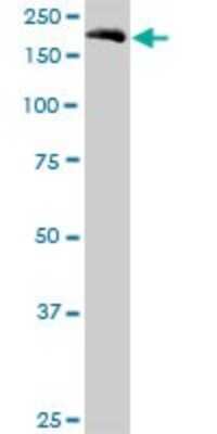 Western Blot: Eukaryotic translation initiation factor 5B Antibody [H00009669-B01P]