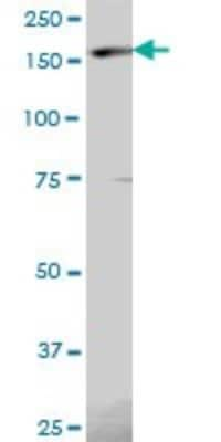 Western Blot: Eukaryotic translation initiation factor 5B Antibody [H00009669-B01P]