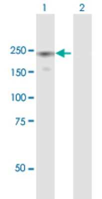 Western Blot: Eukaryotic translation initiation factor 5B Antibody [H00009669-B01P]