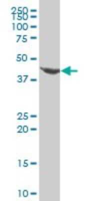 Western Blot: Evx1 Antibody (1B7) [H00002128-M07]
